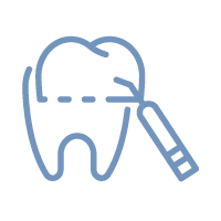 詰め物・被せ物