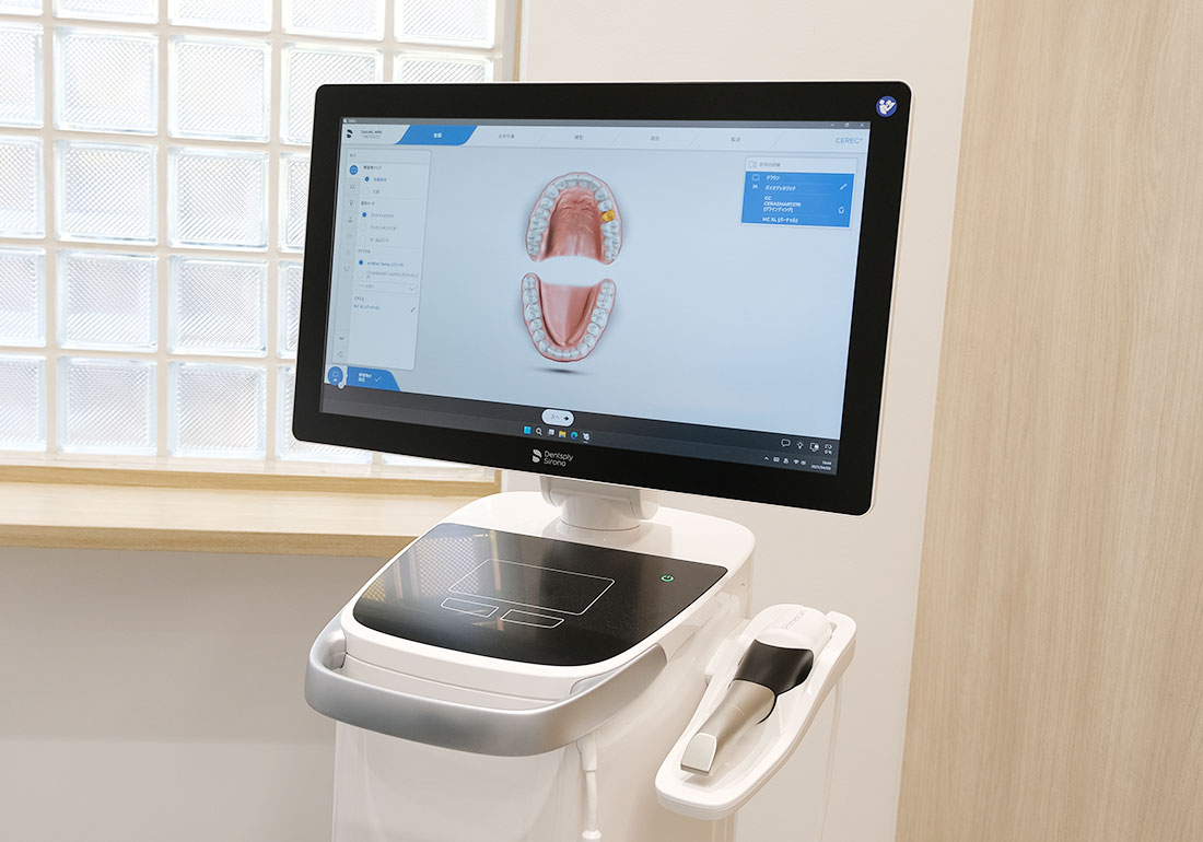 口腔内スキャナー