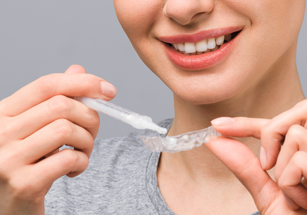 ホワイトニング